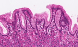 La fisiología de la célula parietal