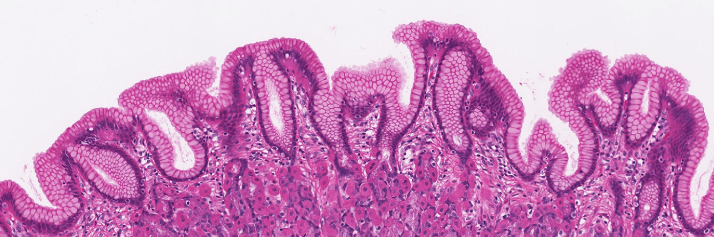 La fisiología de la célula parietal